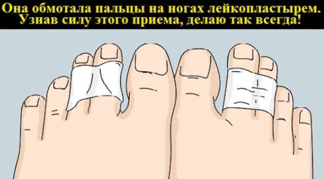 ona-obmotala-paltsy-na-nogah-lejkoplastyrem-uznav-silu-etogo-priema-delayu-tak-vsegda-1