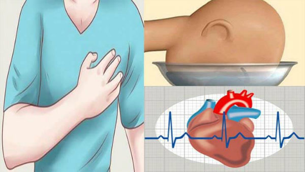 tachycardia