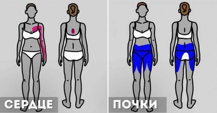 Как понять, что на самом деле у вас болит Как понять, что на самом деле у вас болит