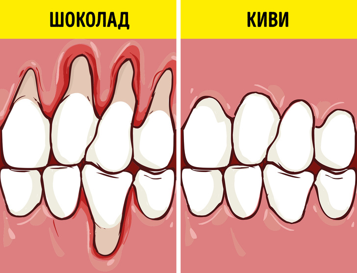 Как сохранить здоровье зубов и отбелить их с помощью еды Как сохранить здоровье зубов и отбелить их с помощью еды