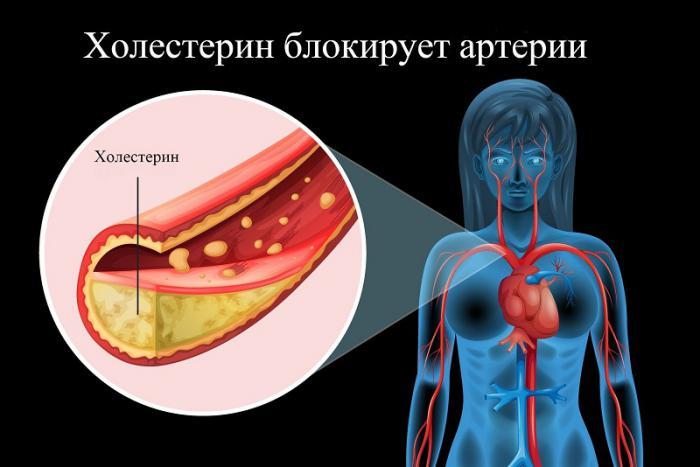Держи сосуды в чистоте и тонусе: 5 золотых рецептов от травника