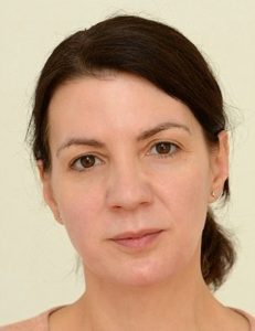 Эта женщина пила 3 литра воды в день в течение 4 недель. И вот что из этого вышло!