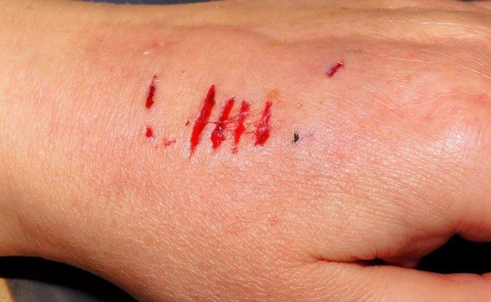 Универсальный помощник: 10 способов использования сахара в быту