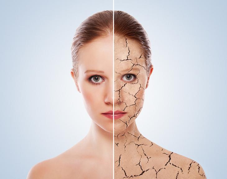 Важные сигналы. Что кожа говорит о вашем здоровье
